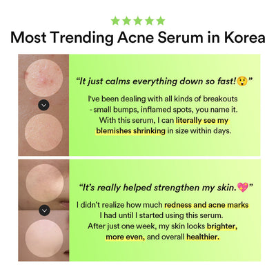 Abib - Heartleaf TECA capsule serum Calming drop