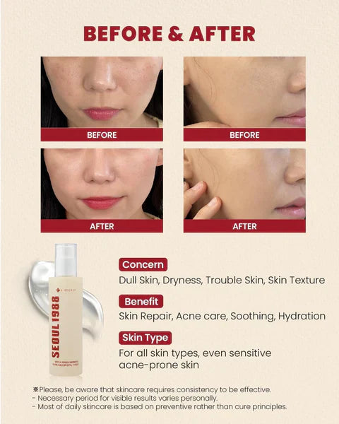 KSECRET - SEOUL 1988 Essence : Snail Mucin 97% + Rice